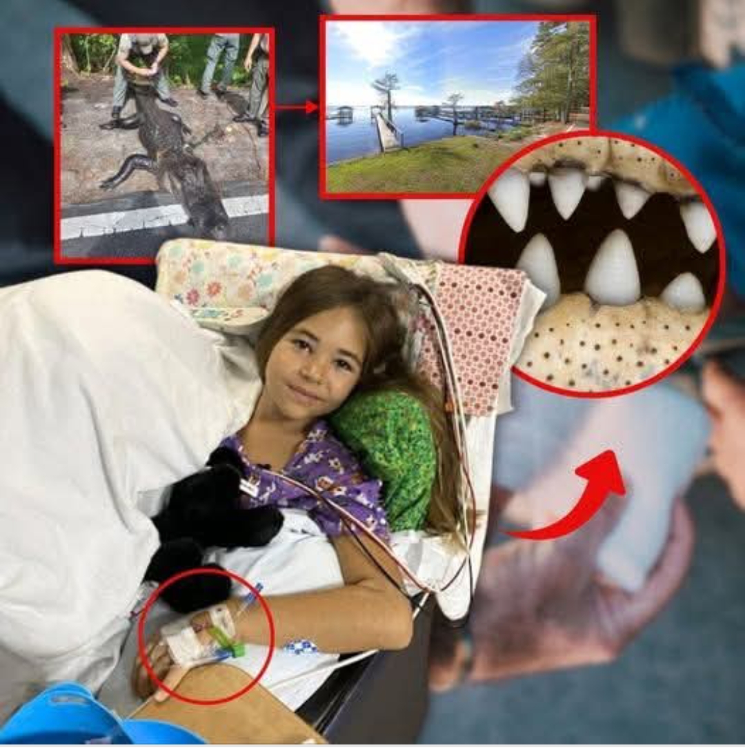 A 12-year-old girl was injured by an alligator at a lake in North Carolina, the first of such an incident in the area’s history, authorities said.— (Full Details Below👇)… See more